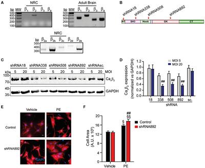 The β2-Subunit of Voltage-Gated Calcium Channels Regulates Cardiomyocyte Hypertrophy